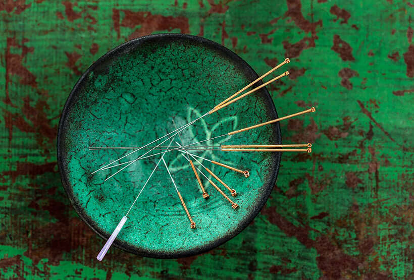 Acupuncturist acupuncture needles in traditional Japanese bowl