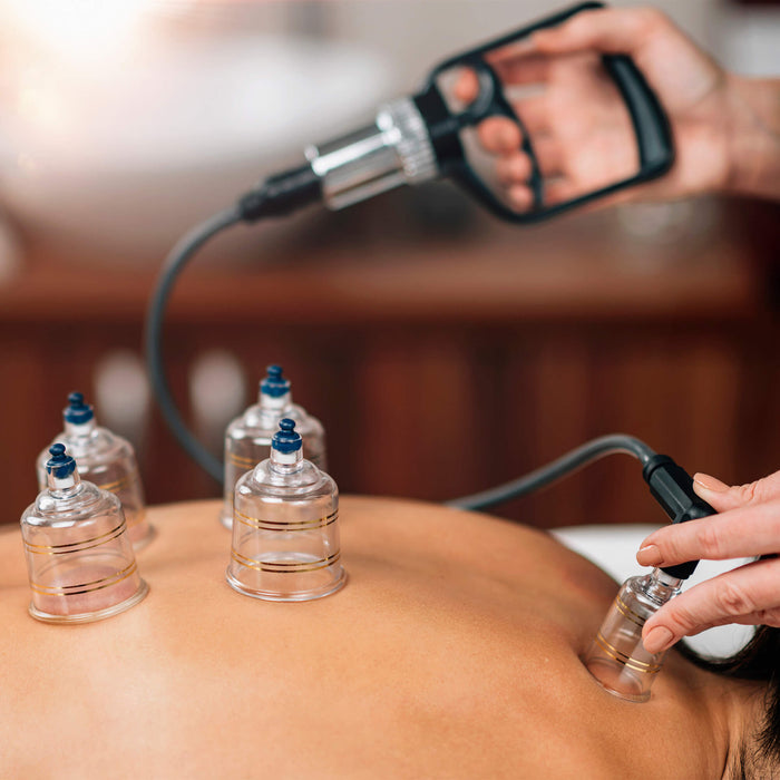 Demonstration of professional cupping set on back of model