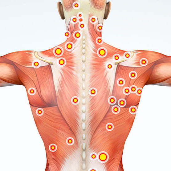 Neck and back trigger points for massage therapy