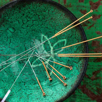 Bodybest 5 Reasons to Try Acupuncture and Visit an Acupuncturist