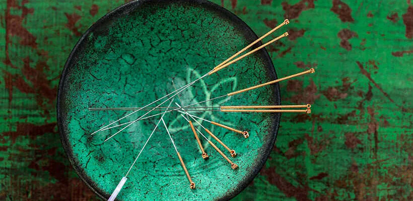 Bodybest 5 Reasons to Try Acupuncture and Visit an Acupuncturist