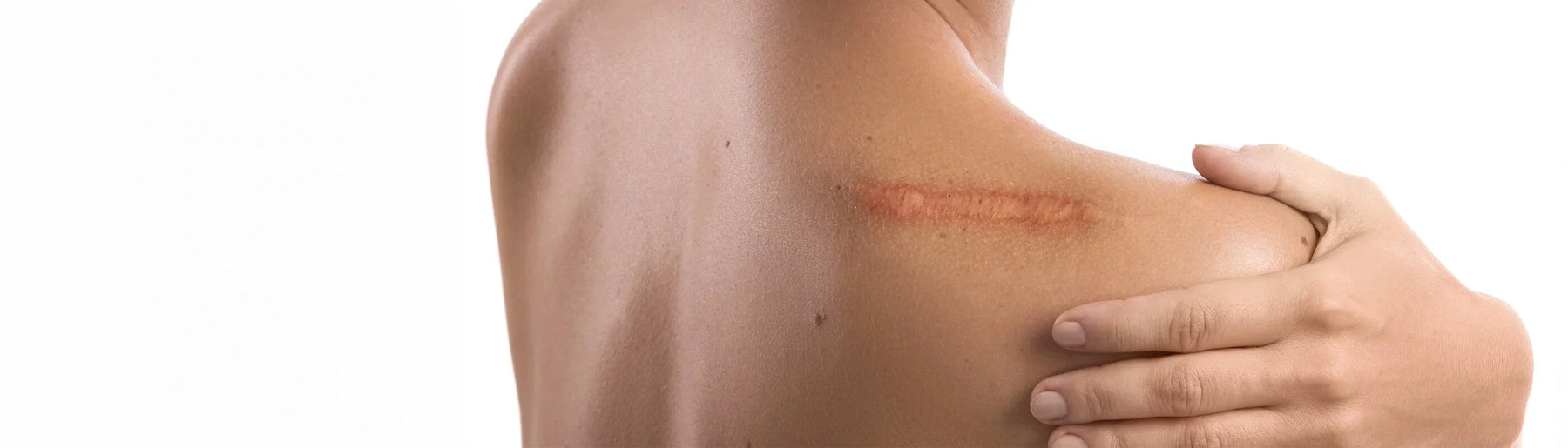 Bodybest Techniques for Addressing Scar Tissue