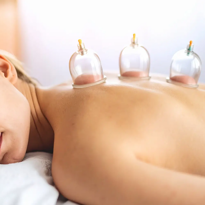 Bodybest what Is cupping therapy