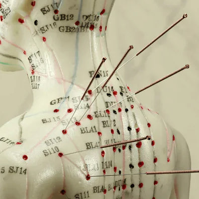 Bodybest The Therapeutic Uses of Acupuncture