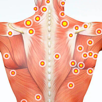 Bodybest Trigger Point Therapy A Targeted Approach to Muscle Pain Relief