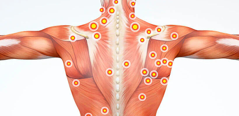 Bodybest Trigger Point Therapy A Targeted Approach to Muscle Pain Relief