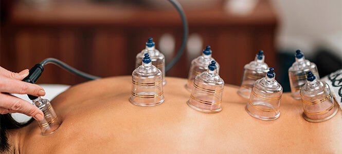 Glass cupping set on models back