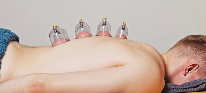 Cupping treatment on male model