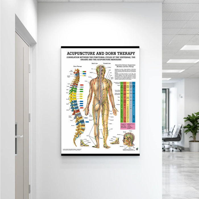 Laminated acupuncture and Dorn therapy chart hanging on a wall, showing detailed body point markings and alignment reference for therapeutic and educational use.