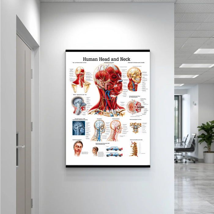 Laminated anatomical head and neck poster hanging on a wall, displaying detailed labeled illustrations of muscles, bones, and nerves for educational use.