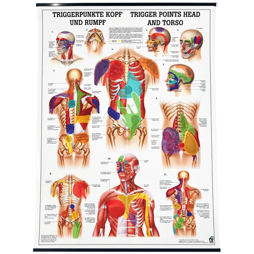 Head and Torso Trigger Point Anatomical Chart 20 x 28 in