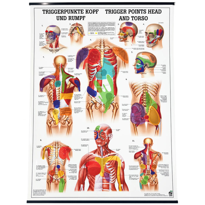 Head and Torso Trigger Point Anatomical Chart 20 x 28 in