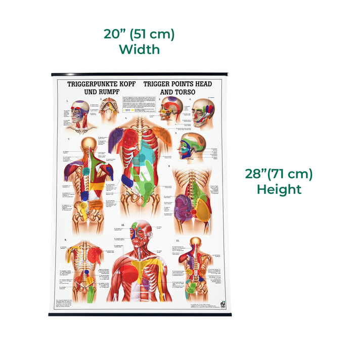 Trigger Point Anatomical Chart showing head torso and muscle trigger points