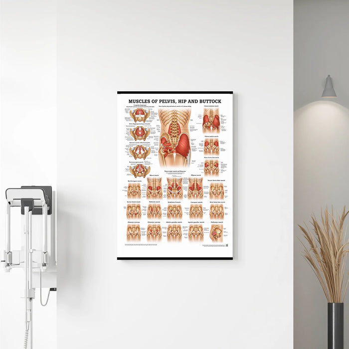 Laminated anatomical chart showing the muscles of the buttock, hip, and pelvis, with labeled muscle groups and detailed medical illustrations hanging on the wall in clinic and teaching settings