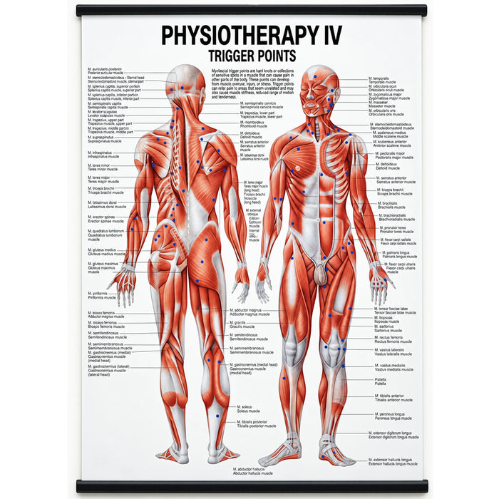 Trigger Points Anatomical Charts