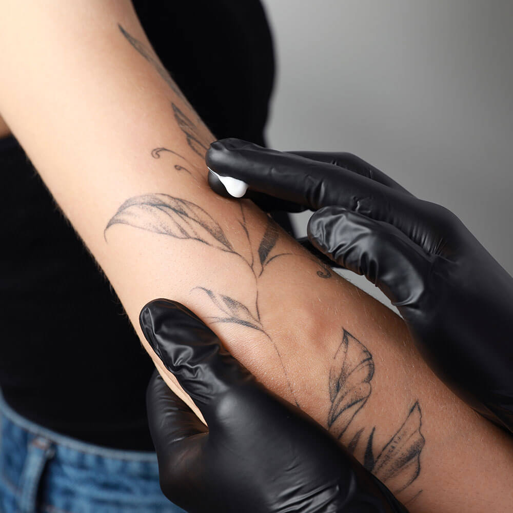 Tattooed arm getting treatment 